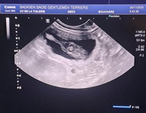 echo sadie nov 2025